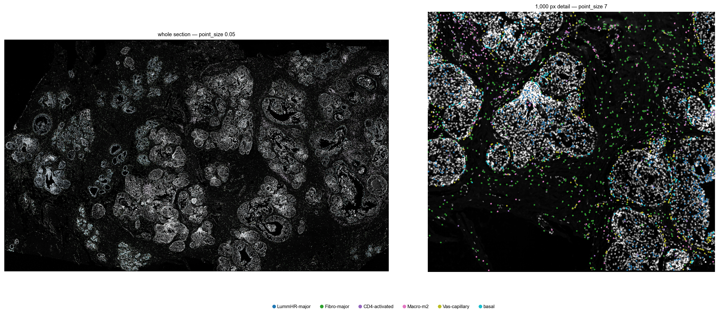Cell types over the DAPI image, whole section and detail
