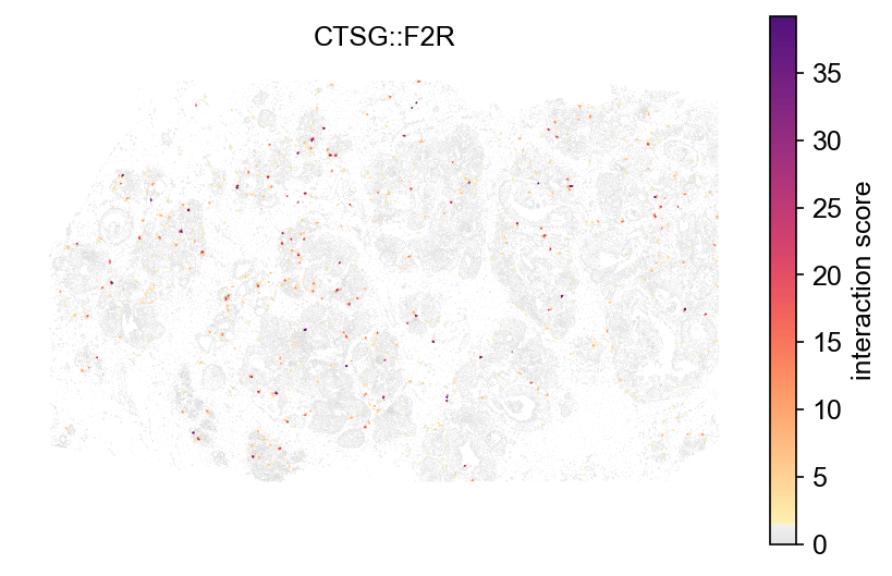 CTSG::F2R across the breast tumour section