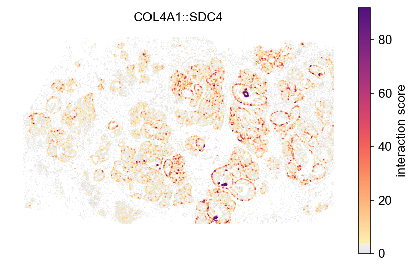 COL4A1::SDC4 across the breast tumour section