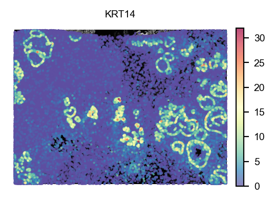 KRT14 expression over the morphology image